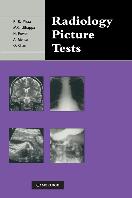 Radiology Picture Tests: Film Viewing and Interpretation for Part 1 FRCR(English)
