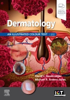 Dermatology: An Illustrated Colour Text(Illustrated Colour Text)