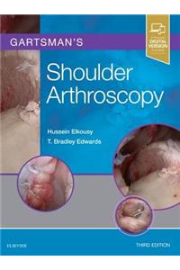 Gartsman's Shoulder Arthroscopy