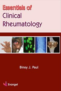 Essentials of Clinical Rheumatology