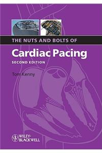 Nuts Bolts Cardiac Pacing 2e