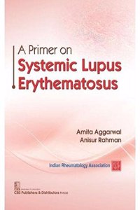 A Primer on Systemic Lupus Erythematosus