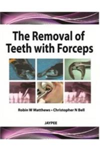 The Removal of Teeth with Forceps