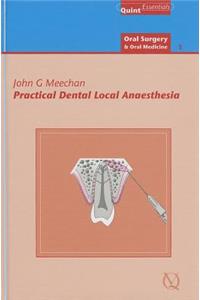 Practical Dental Local Anaesthesia