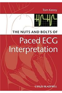 The Nuts and bolts of Paced ECG Interpretation