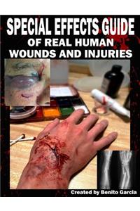 Special Effects Guide Of Real Human Wounds and Injuries