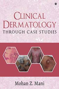 Clinical Dermatology through Case Studies