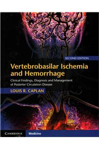 Vertebrobasilar Ischemia and Hemorrhage