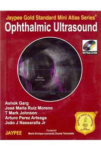 Jaypee Gold Standard Mini Atlas Series: Ophthalmic Ultrasound