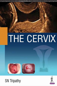 Cervix