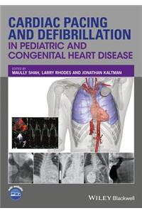 Cardiac Pacing and Defibrillation in Pediatric and Congenital Heart Disease