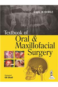 Textbook of Oral and Maxillofacial Surgery