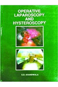 OPERATIVE LAPAROSCOPY AND HYSTEROSCOPY