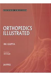 Orthopedics Illustrated