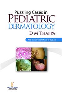 Puzzling Cases in Pediatric Dermatology