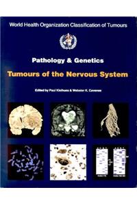 Pathology & Genetics Tumours Of The Nervous System (World Health Organization Classification of Tumours)