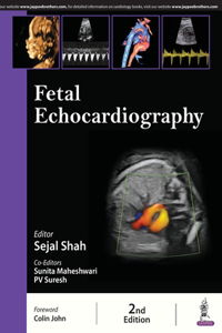 Fetal Echocardiography
