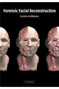 Forensic Facial Reconstruction