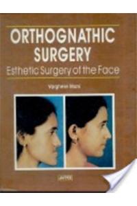 Orthognathic Surgery : Esthetic Surgery of the Face