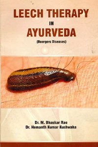 leech therapy in ayurveda