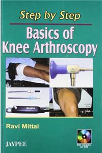 Step by Step Basics of Knee Arthroscopy with CD-ROM