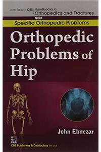 Orthopedic Problems Of Hip (Handbooks In Orthopedics And Fractures Series, Vol. 40: Specific Orthopedic Problems)