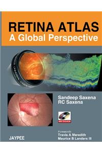 Retina Atlas - A Global Perspective