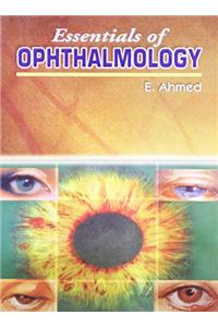 Essentials of Ophthalmology