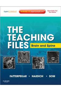 Teaching Files: Brain and Spine