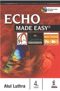 Echo Made Easy