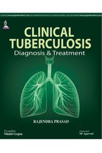 Clinical Tuberculosis Diagnosis & Treatment