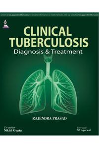 Clinical Tuberculosis Diagnosis & Treatment