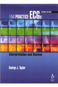 150 Practice ECGs: Interpretation and Review
