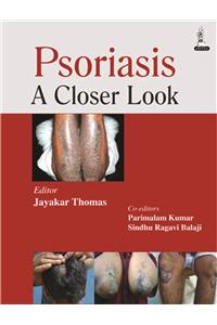 Psoriasis