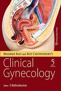 Bhasker Rao and Roy Chowdhuryâ?s Clinical Gynecology (FIFTH EDITION)