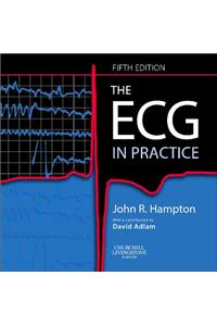 The Ecg In Practice