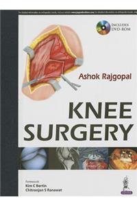 Knee Surgery