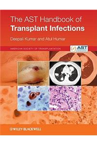 The AST Handbook of Transplant Infections