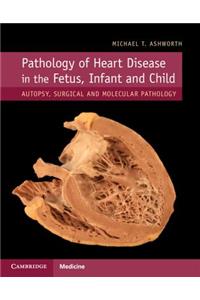 Pathology of Heart Disease in the Fetus, Infant and Child