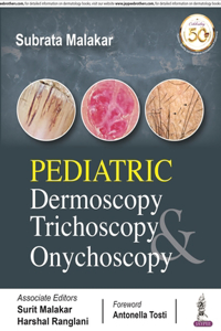 Pediatric Dermoscopy Trichoscopy & Onychoscopy
