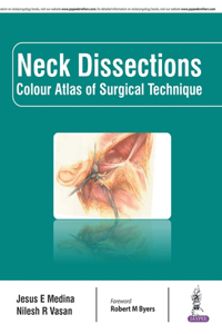 Neck Dissections