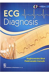 ECG Diagnosis