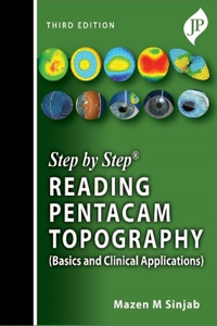 Step by Step: Reading Pentacam Topography