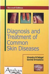 Diagnosis and Treatment of Common Skin Diseases