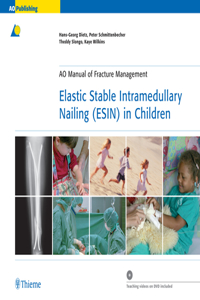 Elastic Stable Intramedullary Nailing (Esin) in Children
