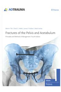 Fractures of the Pelvis and Acetabulum (Ao)