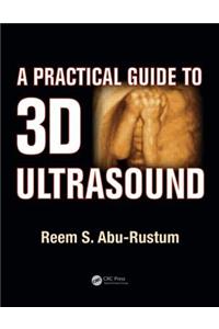 Practical Guide to 3D Ultrasound