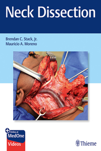 Neck Dissection