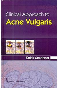 Clinical Approach to Acne Vulgaris