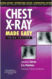 Chest X-Ray Made Easy